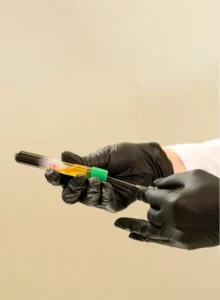 Gloved hands hold a test tube with separated layers of PRP and red blood, capped with a green lid.