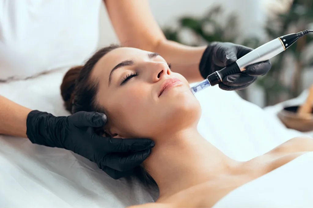 Woman receiving microneedling with PRP treatment