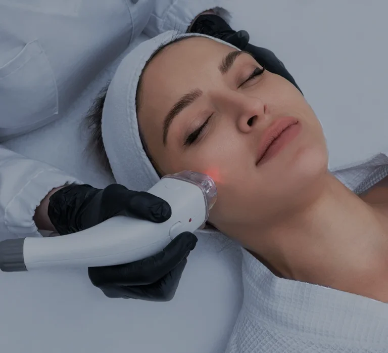 Person receiving LaseMD Ultra laser resurfacing at Point of View Medical Aesthetics
