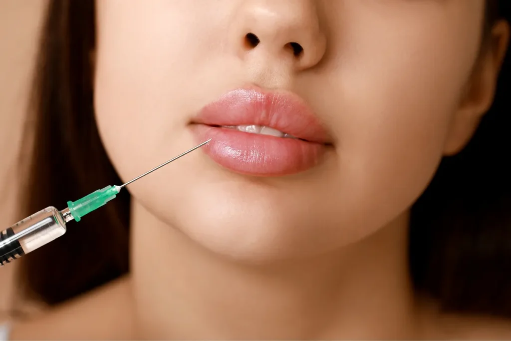 Lip filler aftercare article by Point of View Medical Aesthetics